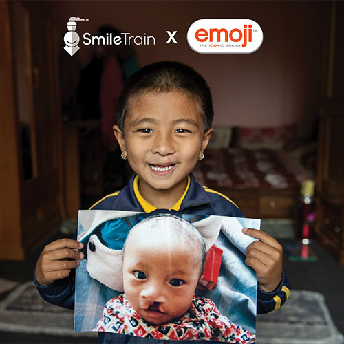 SmileTrainxemoji500x500